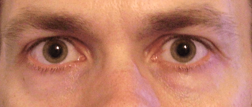 Dilated pupils eye body language