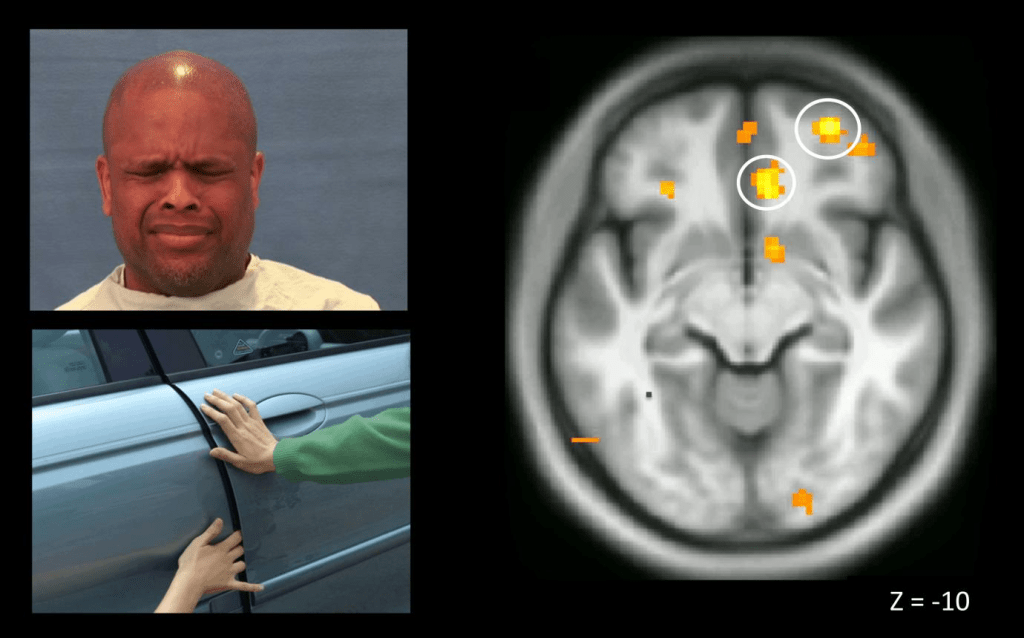 Areas of the brain that light up when feeling empathy